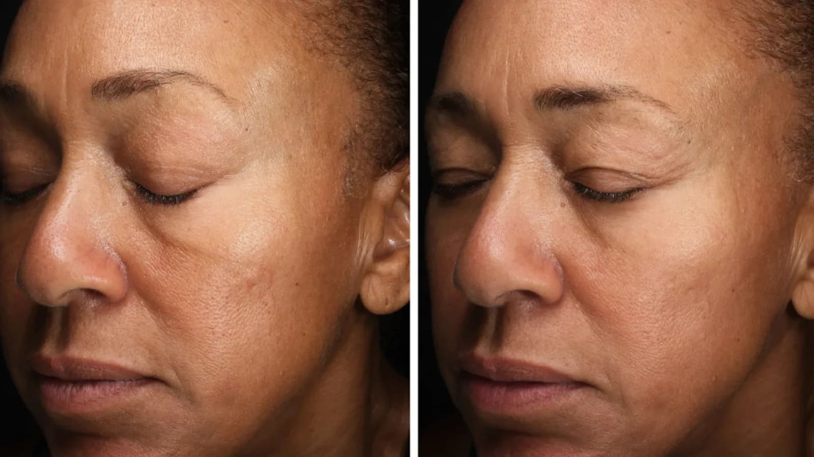 Retinol là gì? Tác dụng, cách dùng và gợi ý một số Retinol tốt nhất